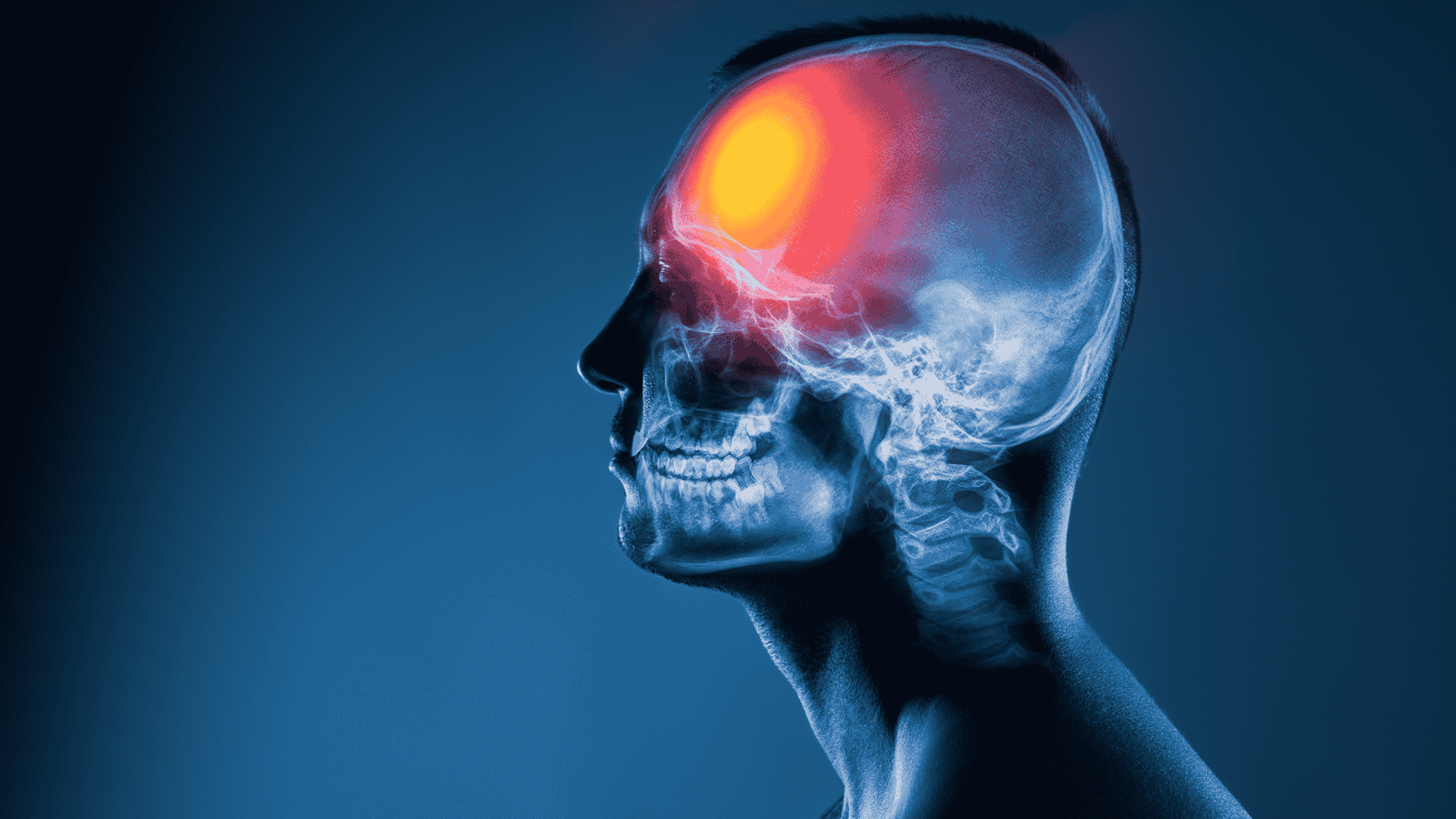 Best brain injury personal injury lawyers in Durham, NC